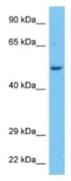PPP2R2A Rabbit anti-Human, Polyclonal, Novus Biologicals:Antibodies:Primary